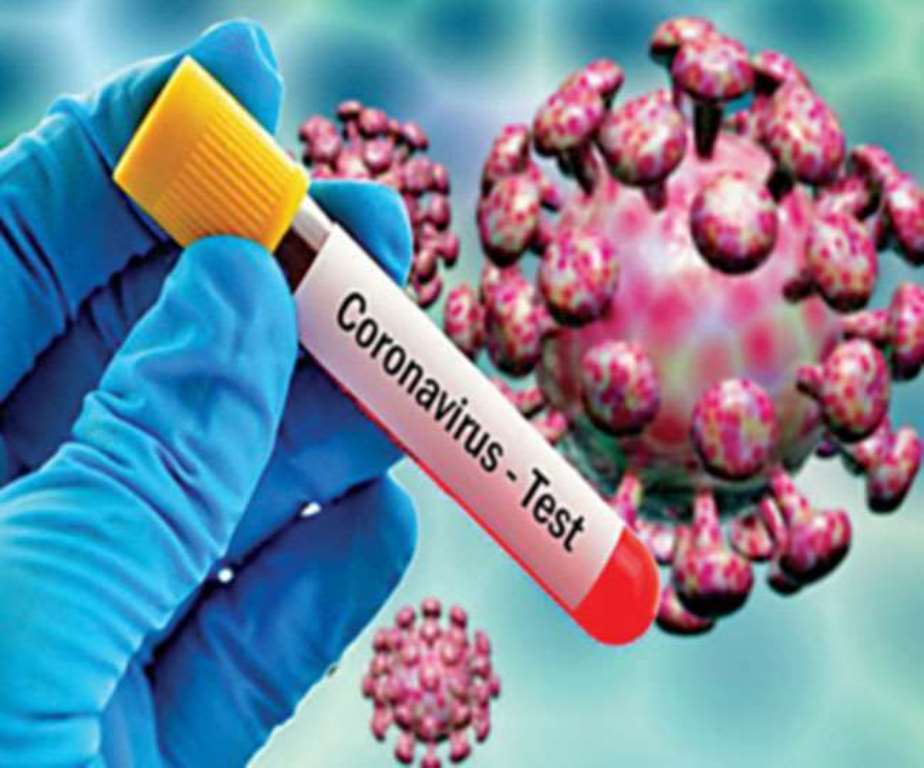 ६४ वर्ष पछि फेला पर्यो अनौठो चरा, आधा मानिस, आधा पंक्षी !
