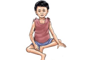 अफगानी बालबालिकामा कुपोषणका कारण ज्यान जाने जोखिम