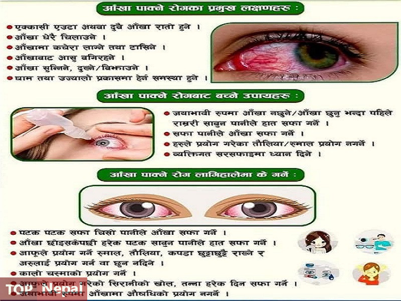 ६४ वर्ष पछि फेला पर्यो अनौठो चरा, आधा मानिस, आधा पंक्षी !