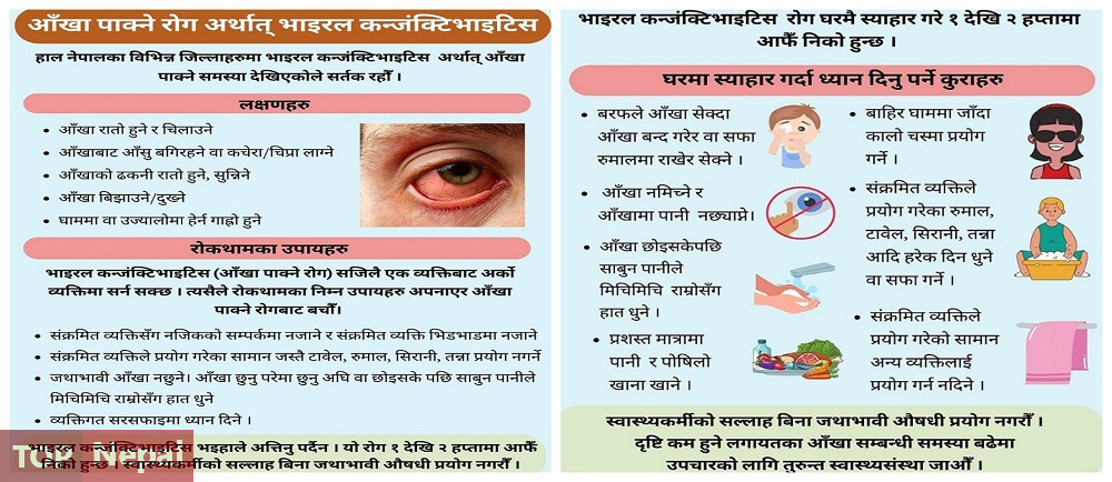 ६४ वर्ष पछि फेला पर्यो अनौठो चरा, आधा मानिस, आधा पंक्षी !